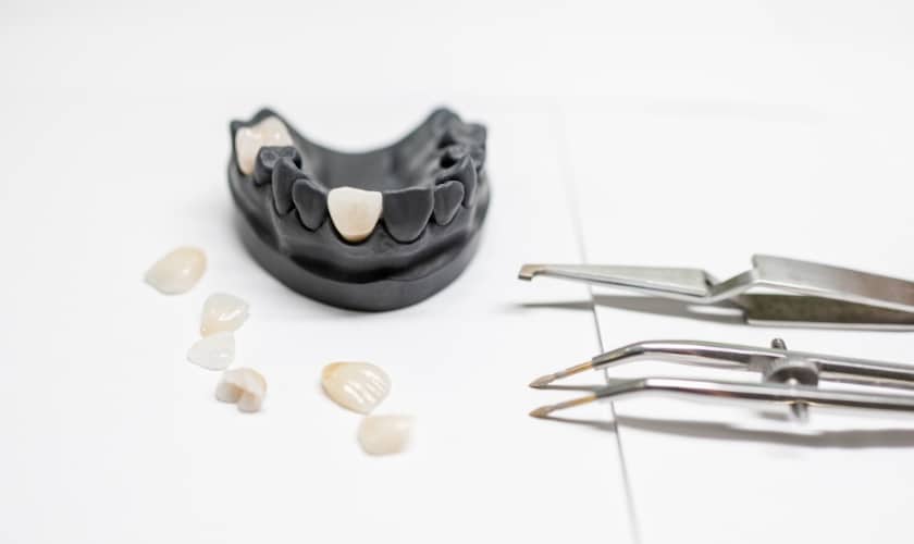 broken dental crowns fixing