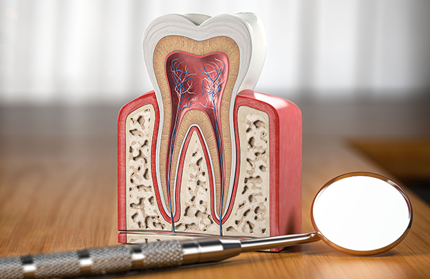 Root Canal in Cottleville