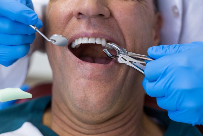 Tooth extraction procedure with care