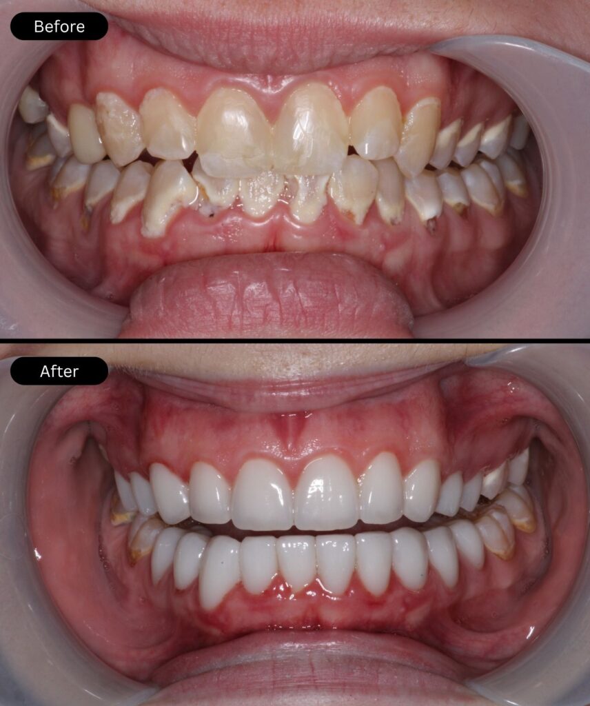 befor-after
