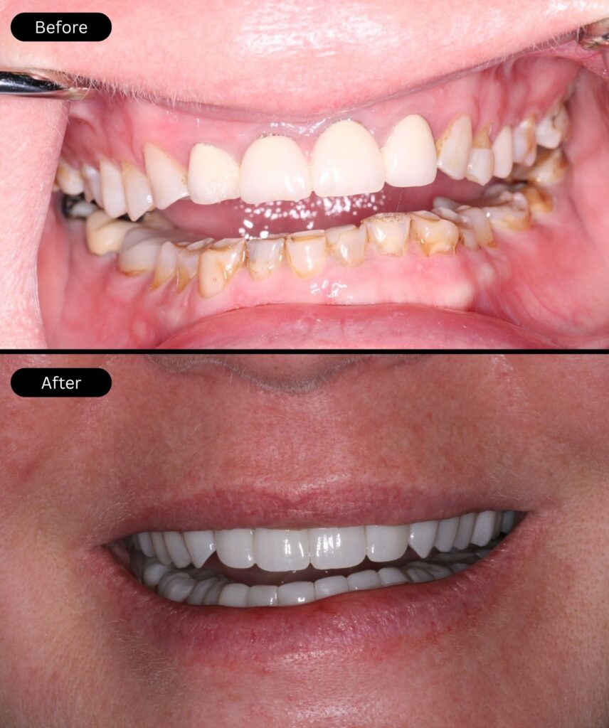 befor-after