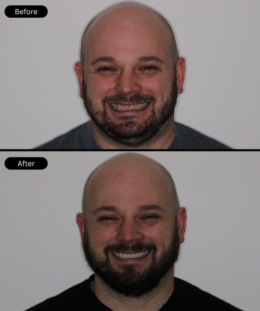 before-after